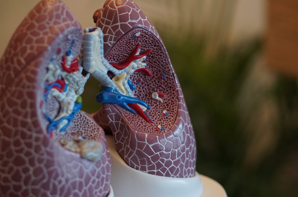 Biomarqueurs génétiques pour le cancer du poumon